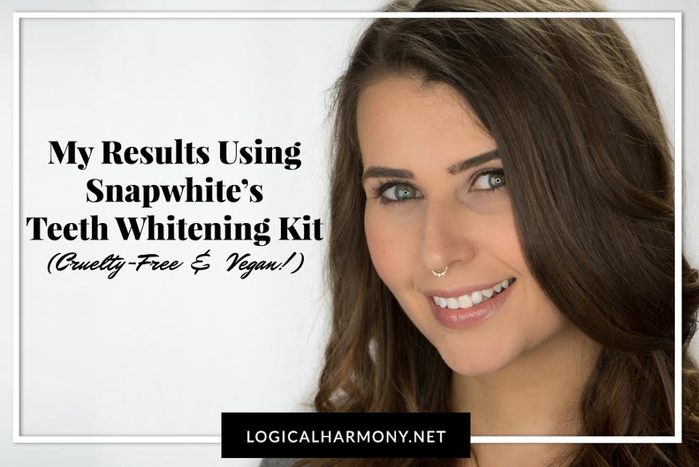 Snapwhite Review - My Results using a Cruelty-Free & Vegan Teeth Whitening Kit